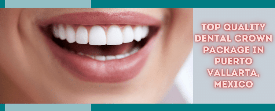 Top Quality Dental Crown Package in Puerto Vallarta, Mexico