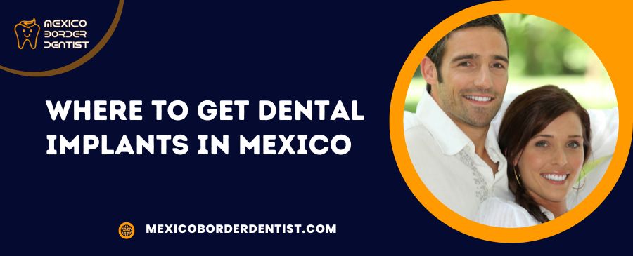 Where to Get Dental Implants in Mexico