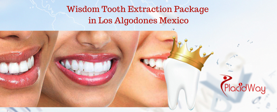 Wisdom Tooth Extraction Package in Los Algodones Mexico