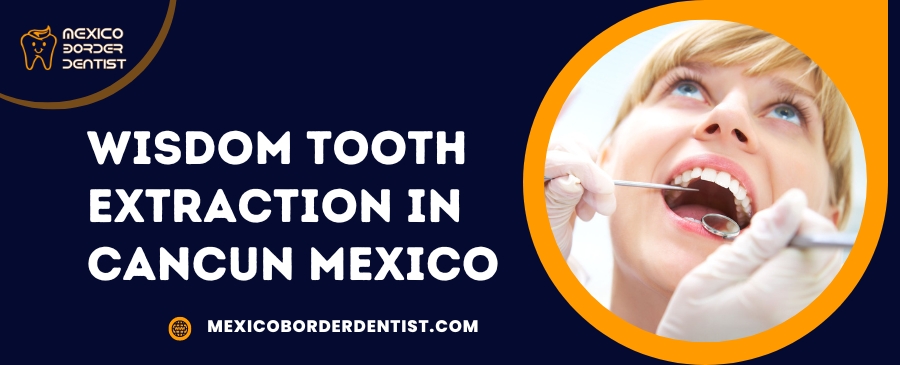 Wisdom Tooth Extraction in Cancun Mexico