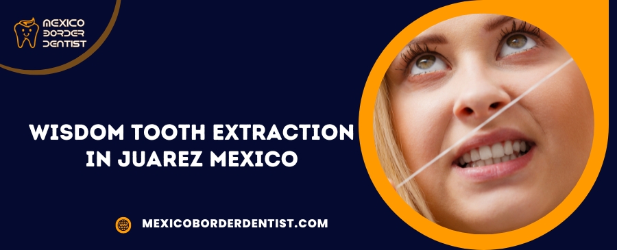 Wisdom Tooth Extraction in Juarez Mexico