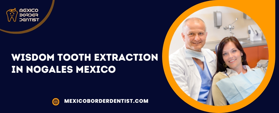 Wisdom Tooth Extraction in Nogales Mexico