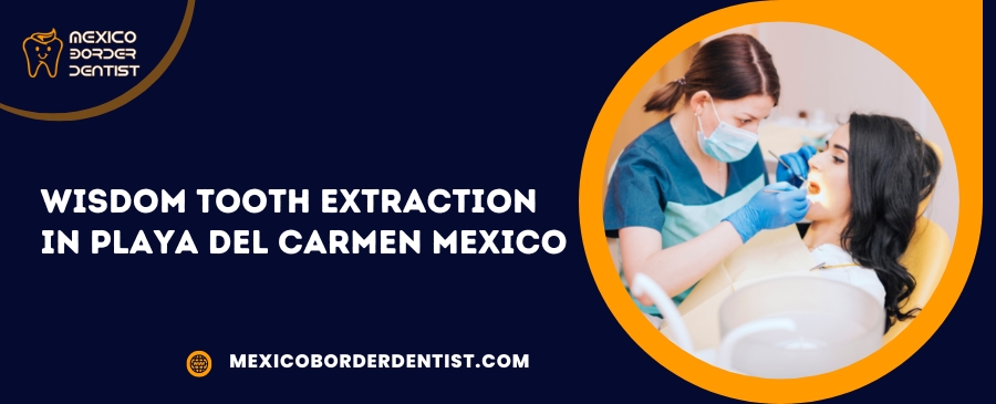 Wisdom Tooth Extraction in Playa Del Carmen Mexico