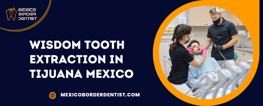 Wisdom Tooth Extraction in Tijuana Mexico