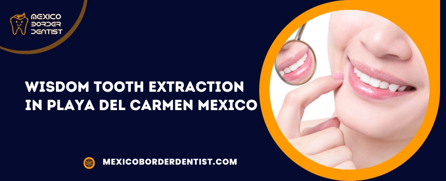 Wisdom tooth extraction in Playa Del Carmen Mexico