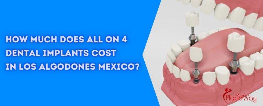 all-on-4-dental-implants-cost-in-los-algodones-mexico