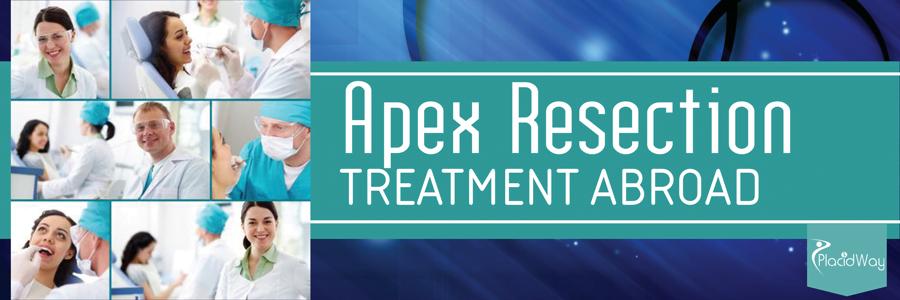 Apex Resection