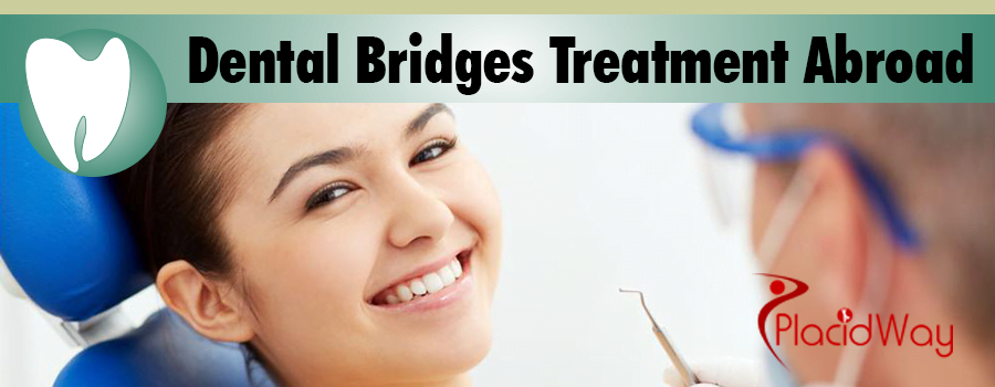 dental-bridges