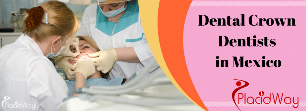 dental crown in mexico