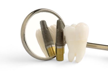 Dental-implants-vs-conventional-dentures