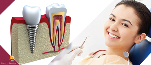 dentures