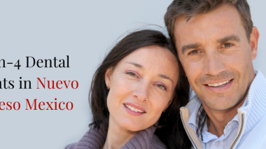 All on 4 Dental Implants in Nuevo Progreso Mexico