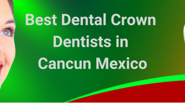 Best Dental Crown Dentists in Cancun Mexico