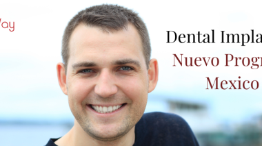 Implantes Dentales en Nuevo Progreso Mexico