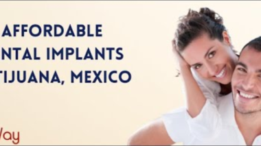 Dental Implants in Tijuana Mexico