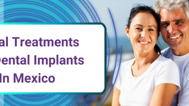 Dental Treatments in Mexico | Dental Implants Information Guide