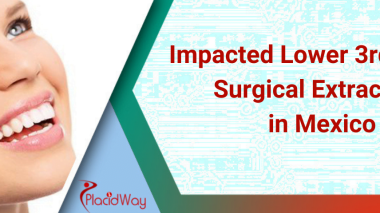 Impacted Lower 3rd Molar Surgical Extraction in Mexico