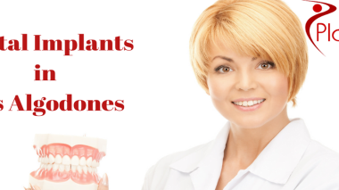 dental implants in los algodones