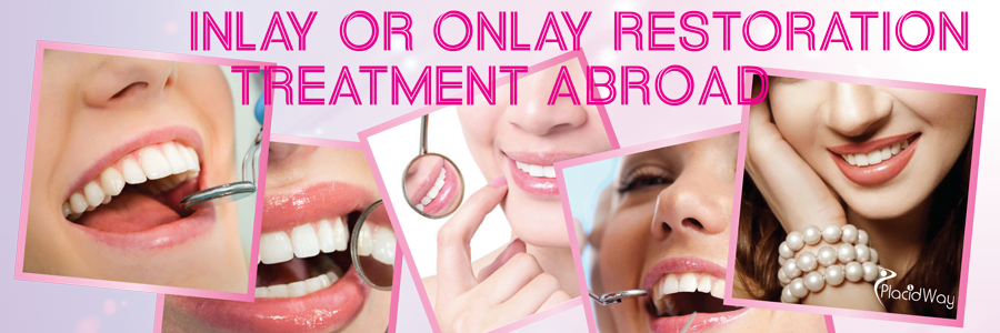 inlay-or-onlay-tooth-restoration-1