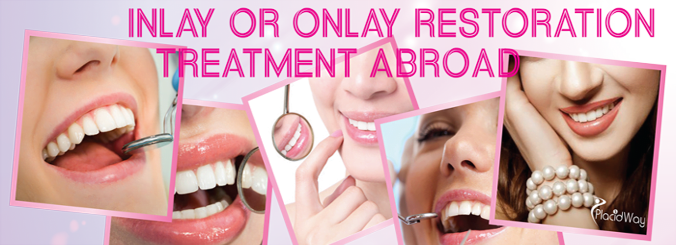 inlay or onlay tooth restoration