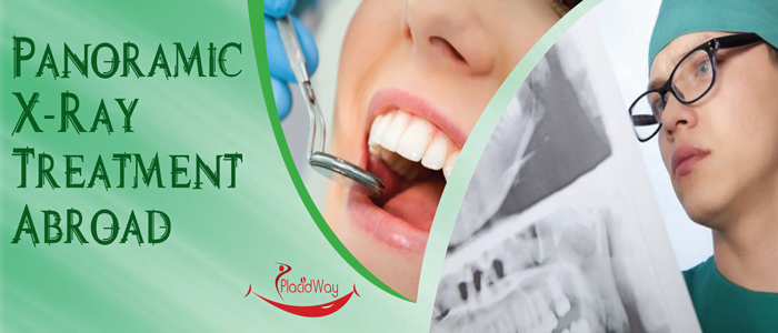 Panoramic X-Ray Treatment