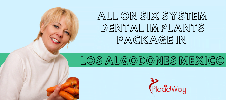 All on 6 Dental Implants in Los Algodones Mexico
