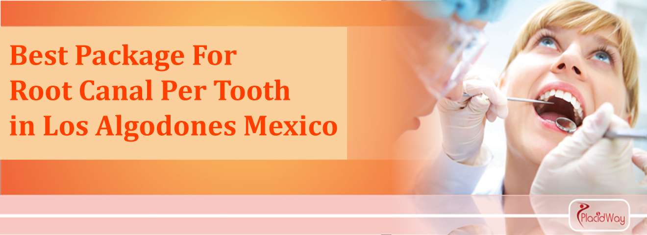 Root Canal per tooth in los algodones