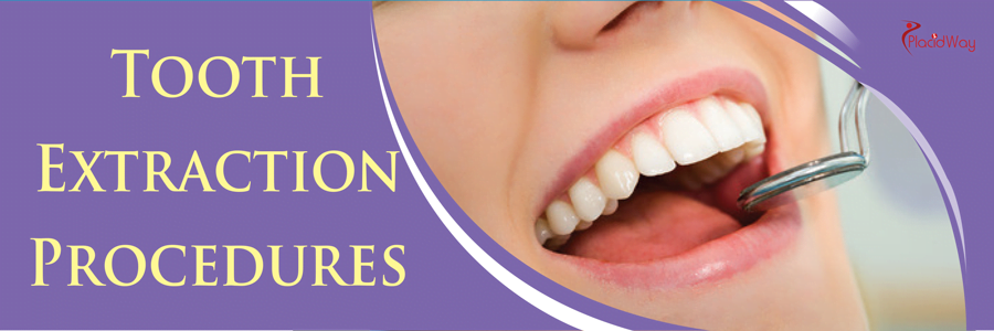 tooth-extraction