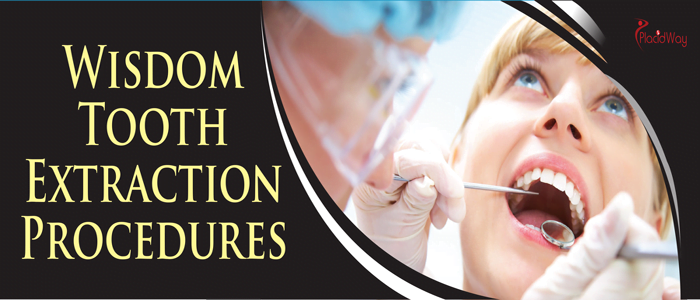 wisdom tooth extraction procedures
